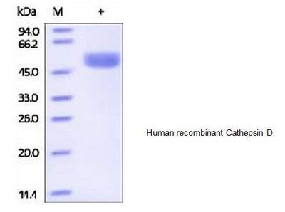 7409-10 - Размер: 10 микрограма - Човешкият на клетъчния катепсин D, рекомбинантный човешки - Всеки (10 микрограма)